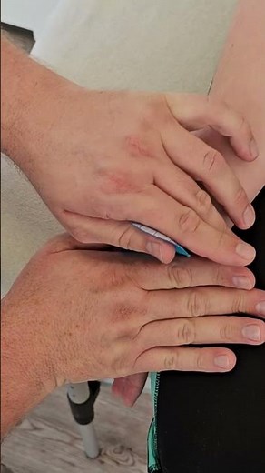 Handgelenk tapen bei Sehnenscheidenentzündung