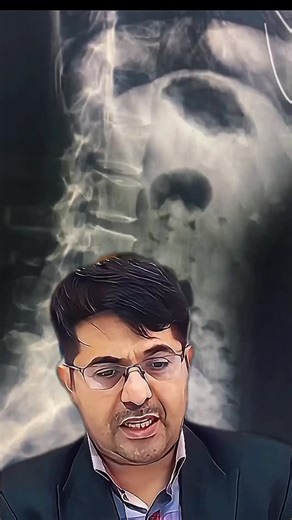 ‎محمدحسین نظام زاده|طب سنتی‎ on Instagram‎: "مشکل دیسک🦴 . #دیسک #بستنی #بیماری #طب_سنتی"‎