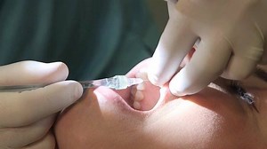 11K views · 162 reactions | The Wand® is virtually painless and builds practices by greatly improving patient satisfaction. | Henry Schein Dental | Facebook