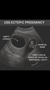 8.9K views · 55 reactions | #USG | CT Scan and MRI study | Facebook