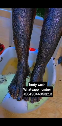7.9K views · 19 reactions | body wash works for stretch marks dark spots dark knuckle and lightning the skin and make it fresh and smooth | Joyce page | Facebook