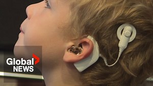 “Hearing shouldn't be for the privileged”: Ontario family fights for cochlear implant coverage - The Global Herald