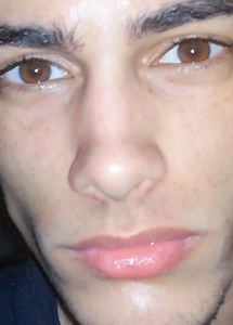 Damp Skin & Salicylic Acid Before Bed