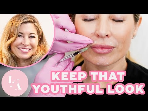 Helen | Lower Face Botox Experience