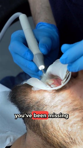 This Toothbrush Hack Saved My Patients THOUSANDS! 🪥💰 #dentist #teeth #toothbrush