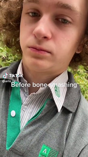 Next: bone smashing tutorial