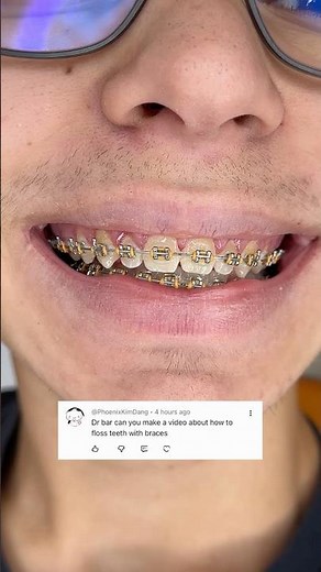 How To Floss With Braces (Easy Step-By-Step)