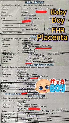 boy baby ಗಂಡು ಮಗು 3,5,6,9ತಿಂಗಳ boy baby scan report😍👦#ultrasound #babyboysymptoms #ultrasound #feed