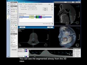 3D Segmentation - Airway Segmentation