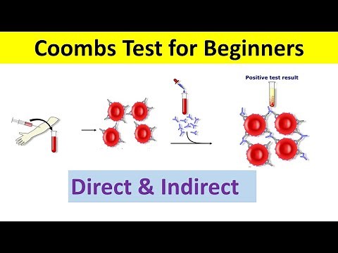 Coombs Test: Principle, Types, Procedure, Interpretation | Coombs test Direct and Indirect