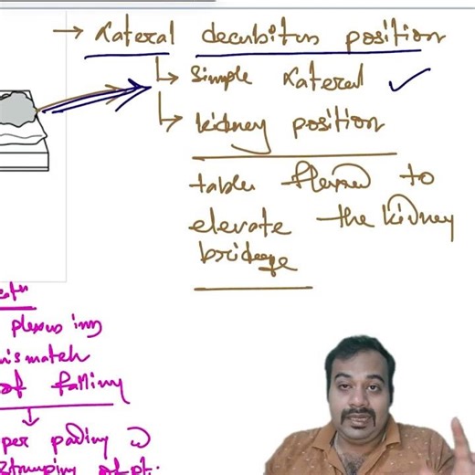 "Simple vs Kidney Position - Medical Tutorial"#medicoapps #inicet #neetpg #anatomy #DrSoumyaBanerjee