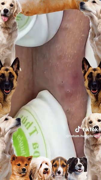 Amazing Cyst Popping Techniques You Need to See