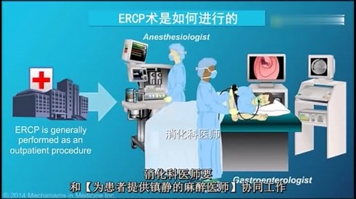 动画-经内镜逆行性胰胆管造影术(ERCP)