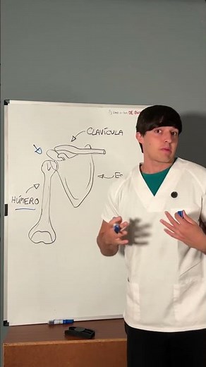 Clavicle fracture explained