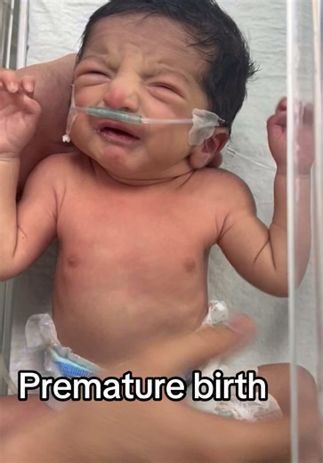 Understanding Premature Birth at 29 Weeks