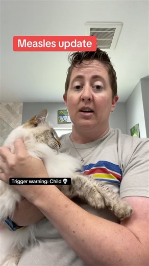 339K views · 6.5K reactions | A young child in #Ontario has passed away from #Measles. Complications and hospitalizations are common with measles, but can be reduced or avoided all together by vaccination #outbreak #travel #vaccine Disclaimer: For educational and entertainment purposes only and should not be regarded as medical advice or replace the advice of your physician | Dr.Beachgem10 | Facebook