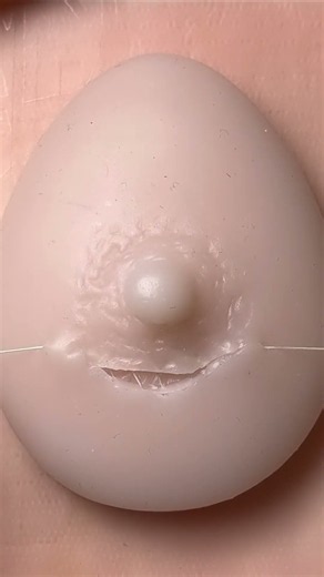 Running subcuticular suture