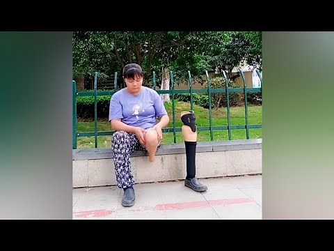 One Leg Amputee Woman Visiting City Park | Stump Workout | Amputada