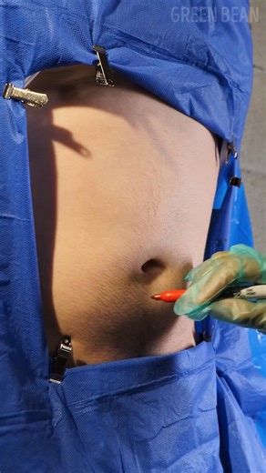 Learning the surgeon’s role with a simulated operation | Green Bean