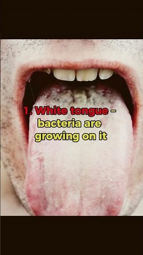 “3 Easy Ways to Get Rid of Bad Breath Fast”