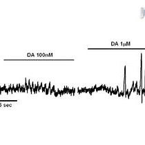Video: Physiological Experimentation with the Crayfish Hindgut: A Student Laboratory Exercise