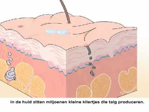 Jeugdpuistjes - Hoe kun je ze bestrijden?