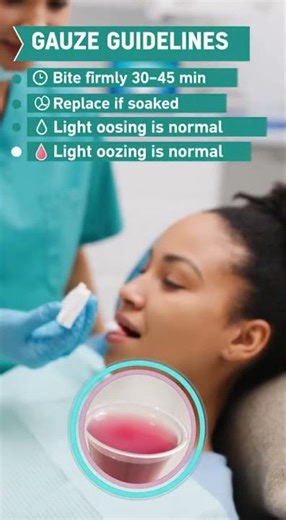 You’re not alone — almost everyone wonders when they can finally take the gauze out.