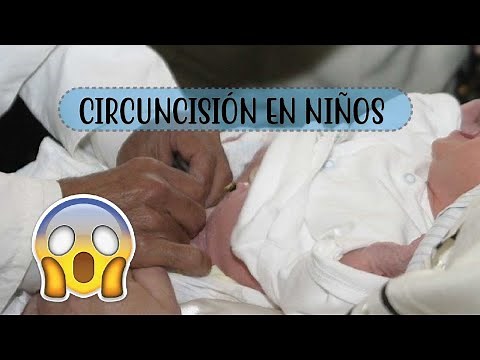 CIRCUNCISIÓN EN NIÑOS