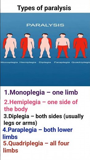 Types of Paralysis Explained | Monoplegia to Quadriplegia (Nursing Notes)