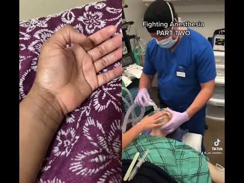 My thumb 👍 picking up automatic randomly TikTok video patient going under anesthesia March 8,2026.