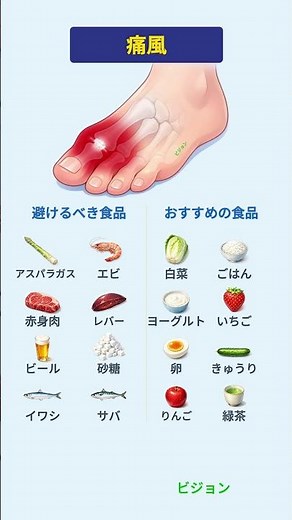 避けるべき食品 VS おすすめの食品：痛風