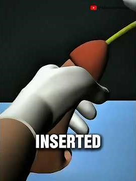 Safe Catheter Insertion Technique Every Nurse Needs #clinicalskills #nursingschool