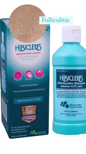 Proper post-waxing care, especially after Brazilian wax care, is essential to ensure a clean wax and prevent this type of reaction in clients. #waxspecialist #vajacialtreament #esthetician #blackesthetician #waxtips