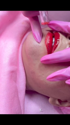 2.1K views · 102 shares | Triple Glow Treatment Kilay by JuLia #koreanfacialtreatment #facialtreatment #koreanbbglowtreatment #bblipstreatment | Kilay by JuLia | Facebook