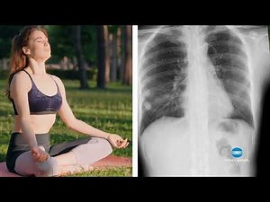Explore Lung Function with Dynamic Digital Radiography (DDR) | Konica Minolta Healthcare
