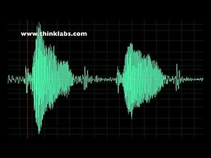Aortic Insufficiency- slow