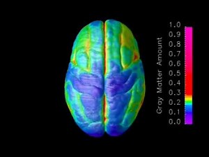Dynamic mapping of human cortical development during childhood through early adulthood
