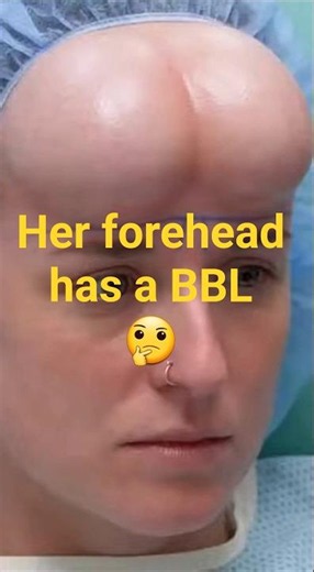 She woke up with a BBL on her forehead. Botched: Episode 21