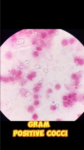 CSF Microscopy / Gram Positive Cocci Under Microscope #mlt #microbiology #shortvideo #medical