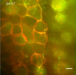 File:Control-of-Directed-Cell-Migration-In-Vivo-by-Membrane-to-Cortex-Attachment-pbio.1000544.s013.ogv - Wikimedia Commons