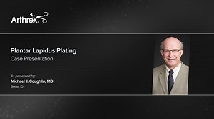 Plantar Lapidus Plating