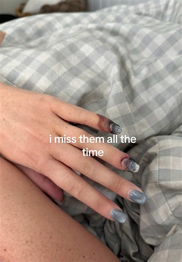 🥲 | gnarled fingers