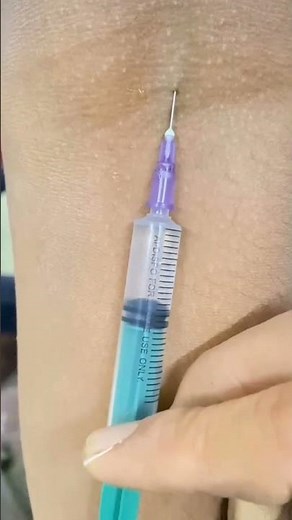 IV injection 💉#shortvideo