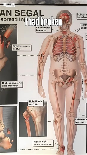 8.2K views · 62 reactions | I Was In A Fatal Car Crash #survivorstories #accident #injuryI | Miracle Survivors | Facebook