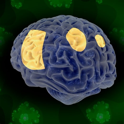This snow globe analogy explains how psychedelics work in the brain. Learn more about what actually happens in the brain during a psychedelic experience: https://to.pbs.org/3DcFZml | NOVA l PBS