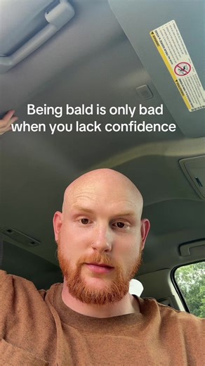 Boosting Confidence for Bald Men: Embrace Your Look