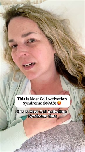 🤯This is what a mast cell activation syndrome (MCAS) flare looks like for me. I’ve been in one for the past two days, and honestly… it came out of nowhere. It could be because I exercised at Pilates. It could be delayed fallout from my immunoglobulin infusion a couple of weeks ago that already triggered a flare and then calmed down for a few days. Or it could just be my body doing what MCAS bodies sometimes do — flaring without a clear reason. And it is miserable.😩 🌟When my mast cells flare, 