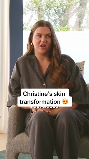 Christine shares her skin transformation ever since starting on Software’s custom skin routine & acne treatment ☺️ link in bio to get started! #skintransformation