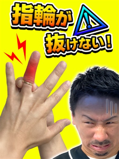指輪が抜けなくなる前に・・・ 備えておきたい救出アイテム✨ ［ 工具紹介 ］ リングカッターは、指輪が抜けなくなってしまったときに、指輪を切断するための工具です。 指に直接刃が触れず、安全に指輪を外すことができます。華奢なリングであれば、1～2分で切断可能です。 切断後にサイズ直しをしたい場合には、デザインに支障が出にくい場所をカットしてください。 使用方法 ①指輪を切断する箇所の反対側からバイス等で指輪を挟み固定します。指輪とリングの隙間にリングカッターの先端を差し込みます。 ②リングカッターの刃を矢印の方向に回転させて切断します。 ③プライヤー等で指輪を広げて取り外す。 ========================== 商品コード：635050 商品名：S&F リングカッター #1353E