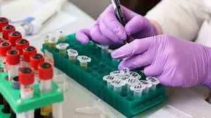 Mekanisme Kerja Tes PCR (Polymerase Chain Reaction)